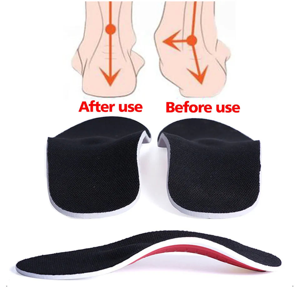 Orthopedic Insole For Flat Foot - Plantar fasciitis