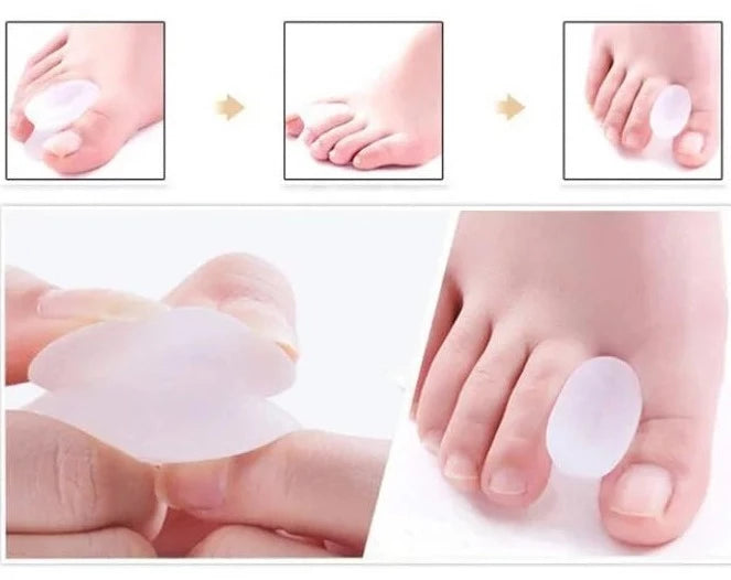 Silicone Toe Separator - Orthopedic Bunion Relief